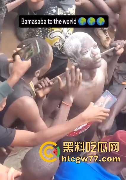 非洲部落割包皮 这也太生猛了吧 包皮一拉一刀下去直接割掉 这老哥全程面无表情！  第4张