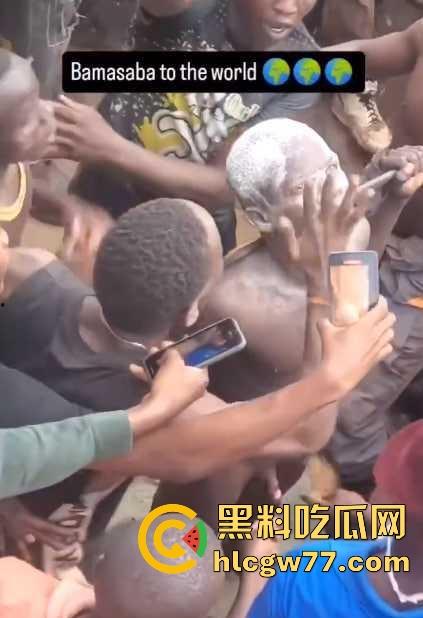 非洲部落割包皮 这也太生猛了吧 包皮一拉一刀下去直接割掉 这老哥全程面无表情！  第5张