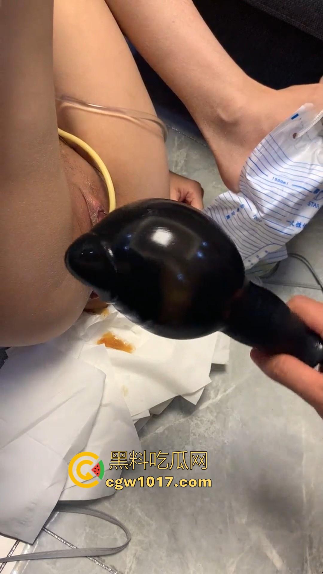 重口慎点！充气式肛塞，导尿管，玩弄穿环女奴！一开始以为平平无奇，拔出来才知道这肛门这么能塞啊！  第8张