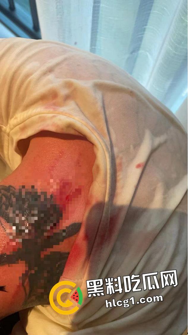 全网丢人的精神小伙【陈浩轩】背着女友偷吃被抓！被女友打的头破血流 现场视频流出  第6张