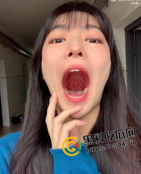 站住！让老夫来帮你做一下核酸检测  在让老夫好好给你检查一下有没有蛀牙 第2张