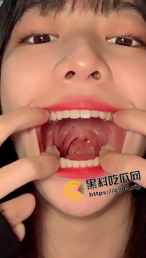 站住！让老夫来帮你做一下核酸检测  在让老夫好好给你检查一下有没有蛀牙 第3张