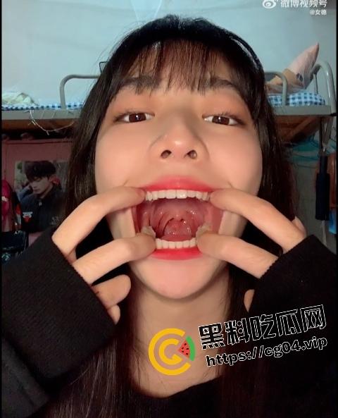 站住！让老夫来帮你做一下核酸检测  在让老夫好好给你检查一下有没有蛀牙 第4张