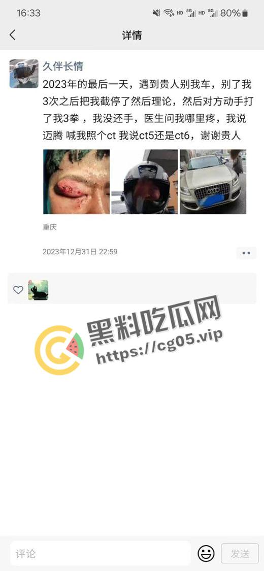 新年遇贵人!重庆渝中摩托佬莫名其妙被奥迪别车三次还挨打 事后律师表示不会少于五万 挨打挨出来一辆新摩托 第1张 新年遇贵人!重庆渝中摩托佬莫名其妙被奥迪别车三次还挨打 事后律师表示不会少于五万 挨打挨出来一辆新摩托 第1张