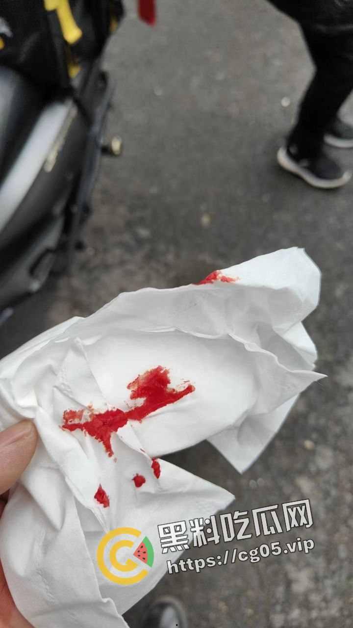 新年遇贵人!重庆渝中摩托佬莫名其妙被奥迪别车三次还挨打 事后律师表示不会少于五万 挨打挨出来一辆新摩托 第6张 新年遇贵人!重庆渝中摩托佬莫名其妙被奥迪别车三次还挨打 事后律师表示不会少于五万 挨打挨出来一辆新摩托 第6张