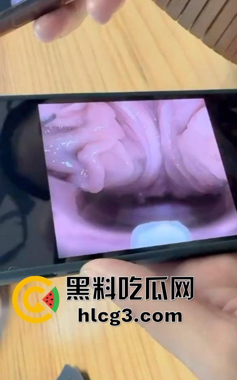 私密处美容：原来也能这样！你一定没见过的私密美容奇招  第5张