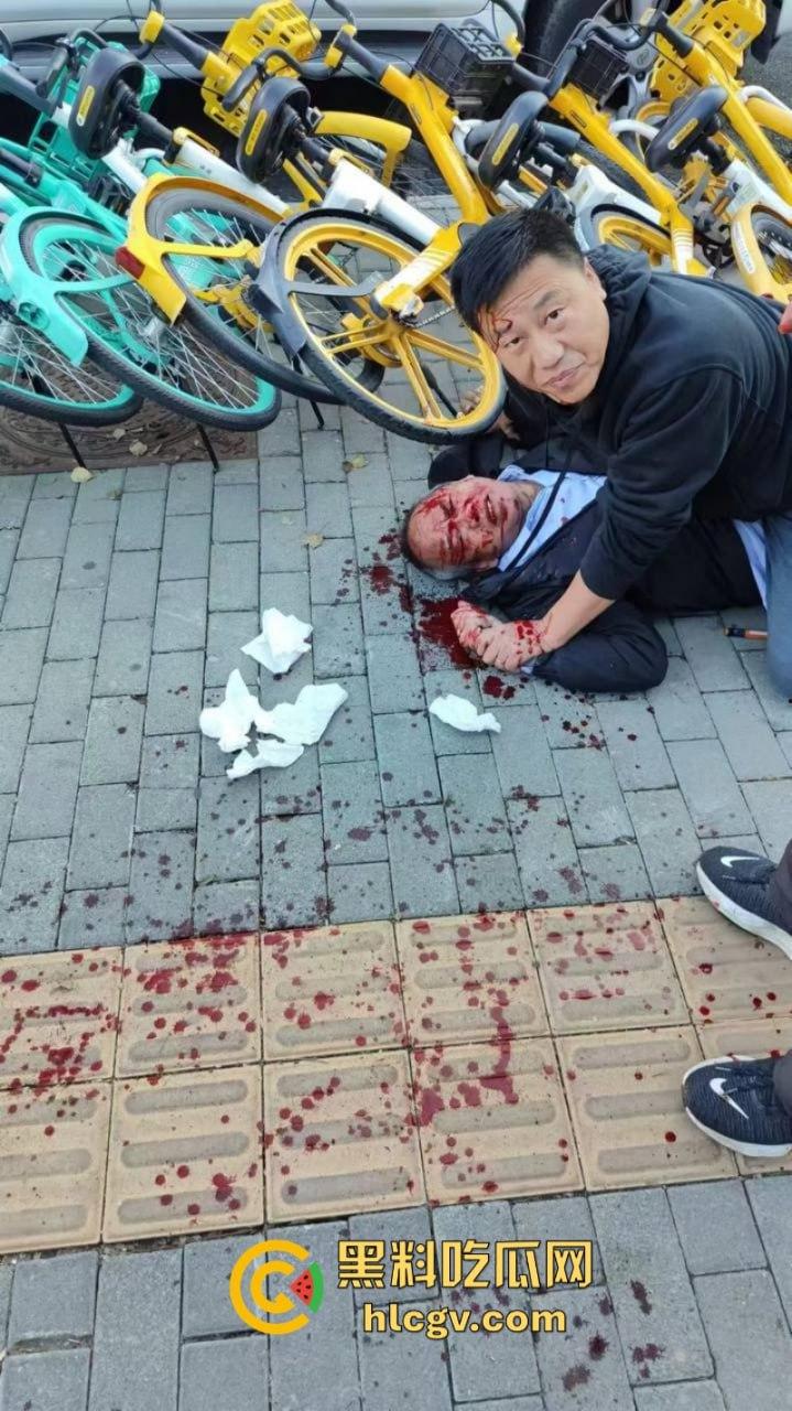 没人性！北京海淀区男子当街砍人报复社会 专挑孩子下手 现场血腥惨烈视频曝光  第11张