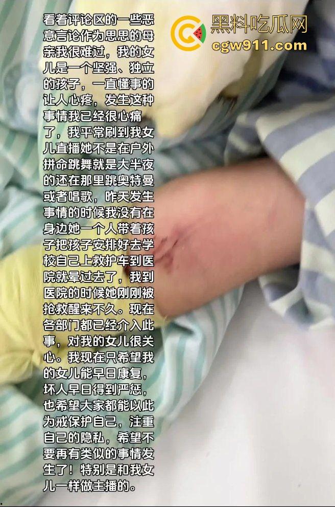 湖南性感擦边主播遭疯狂粉丝寄炸弹包裹炸伤，粉丝疯狂起来真恐怖啊，好端端的性感主播炸成了隔壁大妈！  第8张