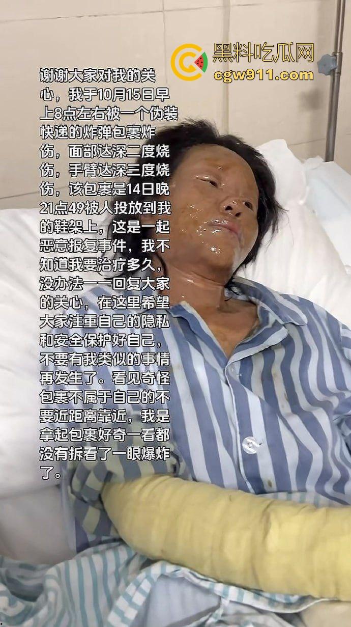 湖南性感擦边主播遭疯狂粉丝寄炸弹包裹炸伤，粉丝疯狂起来真恐怖啊，好端端的性感主播炸成了隔壁大妈！  第9张