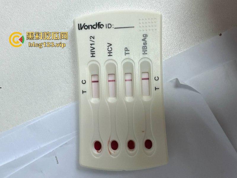 可怕！为了报复社会把带血针头扎进了共享单车的座椅里……山东商业技师学校20个被感染艾滋！！！  第9张