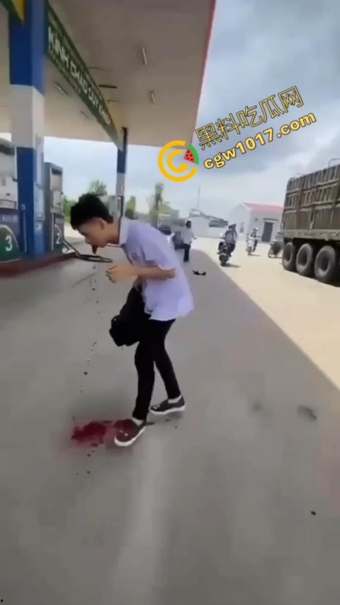 血流如注！越南青年绝地反击，刀刃直捅霸凌者脸颊，鲜血狂涌喷出，震惊全场！  第7张