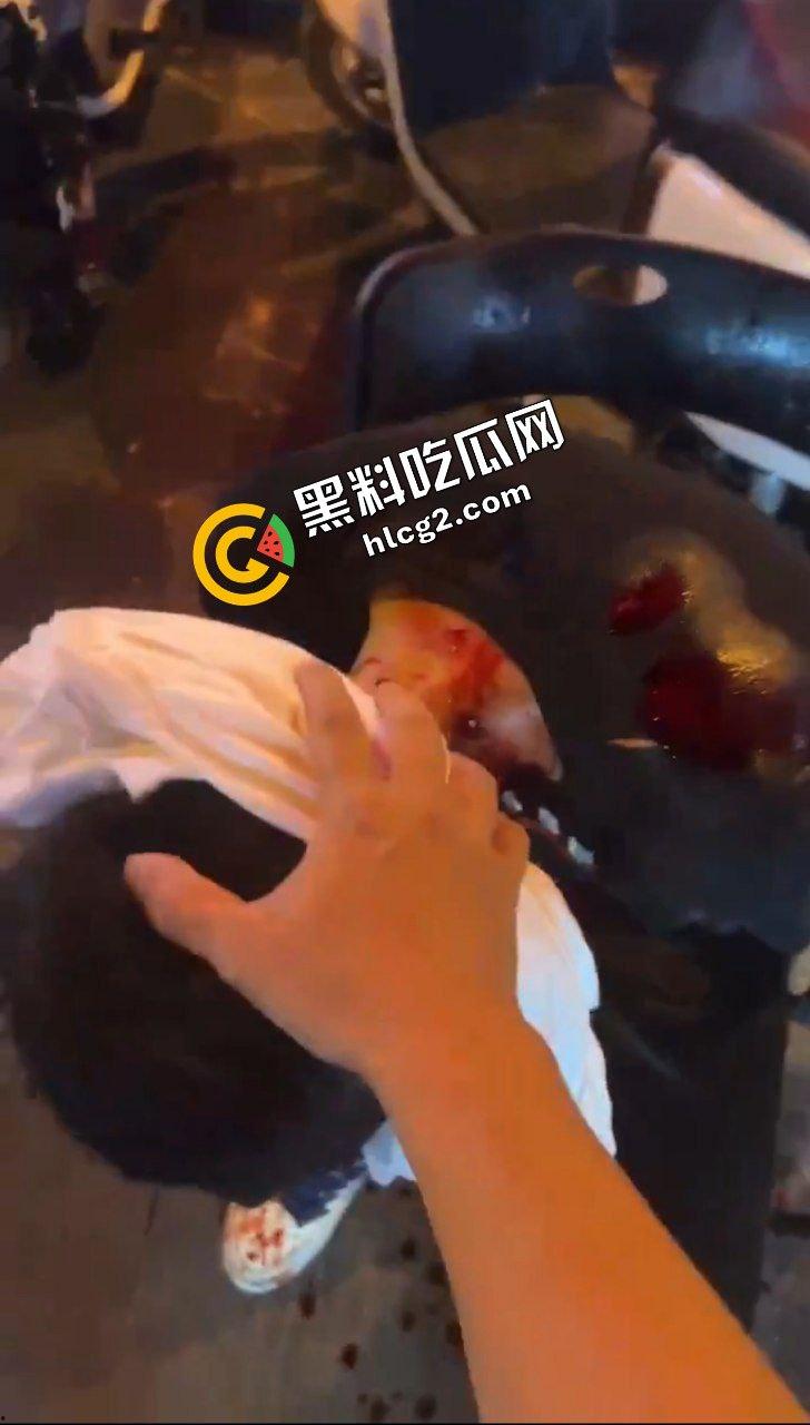 广西玉林南兴广场 精神病男子袭击广场砍人 下死手砍颈动脉 血迹斑斑！致4名小孩受伤！  第8张