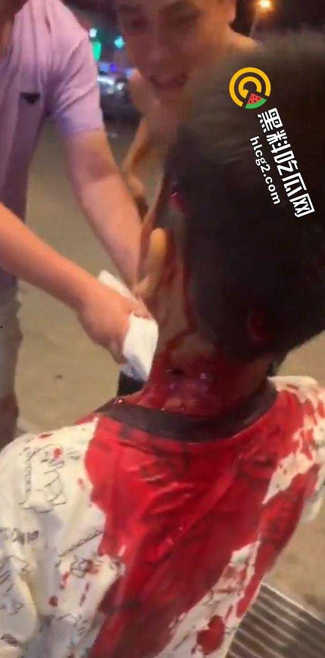 广西玉林南兴广场 精神病男子袭击广场砍人 下死手砍颈动脉 血迹斑斑！致4名小孩受伤！  第9张