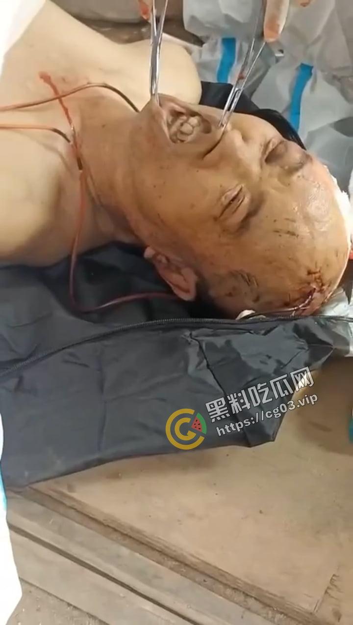 缅甸电诈 四大家族之一的【明学昌】被自杀，尸体拉到中缅边境做尸检 儿子和姑姑自首 现场画面曝光！  第8张