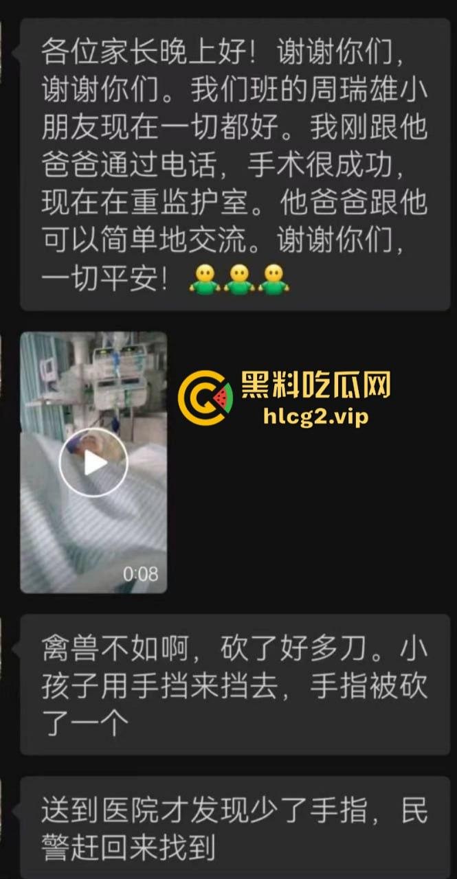 两口子吵架不比谁嗓门大 竟然砍下儿子手指 这操作竟然是亲妈？  第1张