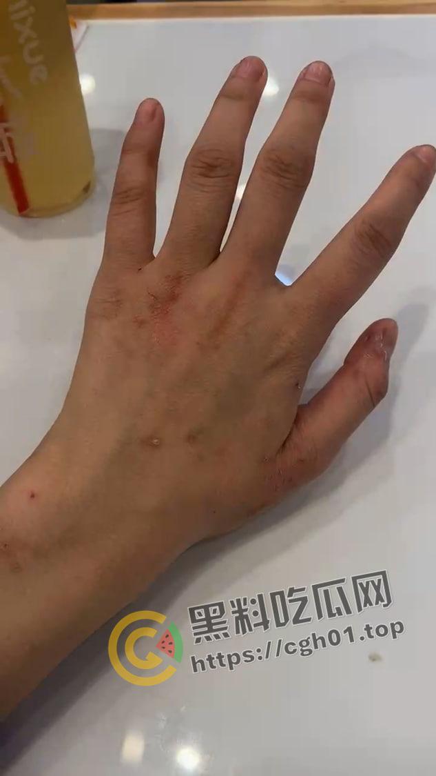 宁波惊现生化母体  圈内全军覆没 医院咨询电话被打爆 夜场公狗母狗的毒圈缩成决赛圈啦 第21张