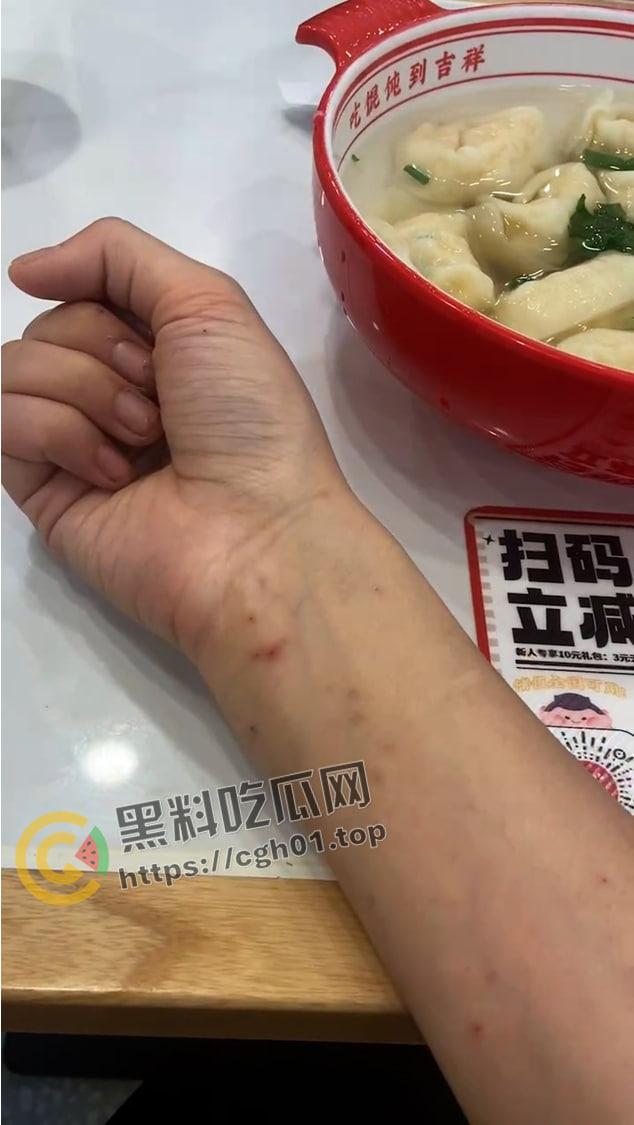 宁波惊现生化母体  圈内全军覆没 医院咨询电话被打爆 夜场公狗母狗的毒圈缩成决赛圈啦 第22张