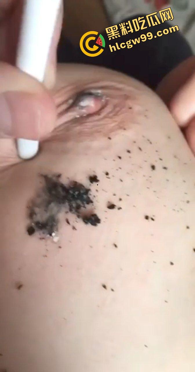 江苏极品E奶大雷少妇骚鸡，尝试猎奇刺激玩法虐乳！暴力夹乳针头注射奶头烟头烫咪咪！诠释何为调教！  第9张