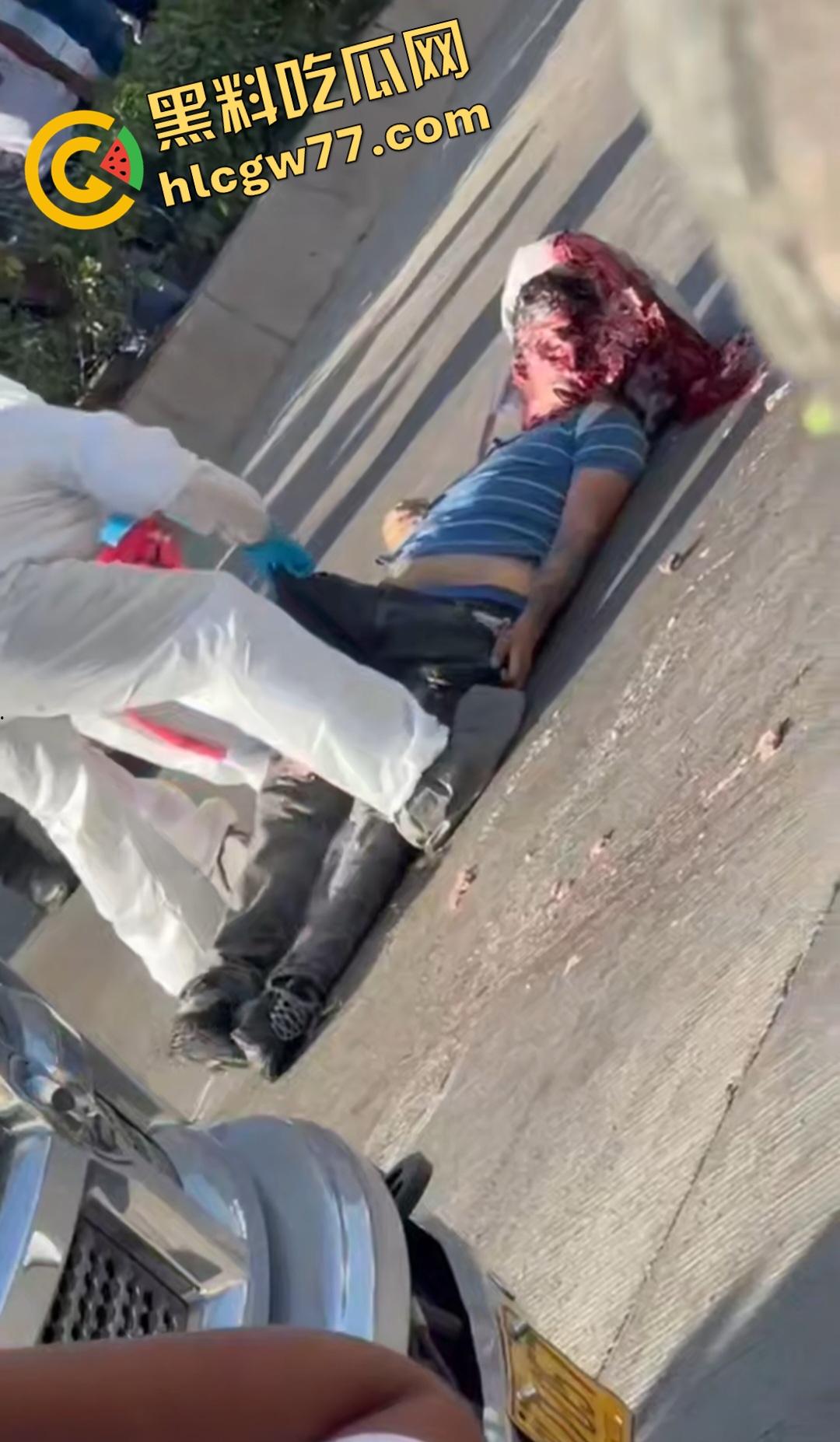 蓝色衣服男电动车车祸爆头血腥惨剧！眼珠弹出还能救？世上竟有神人？  第2张