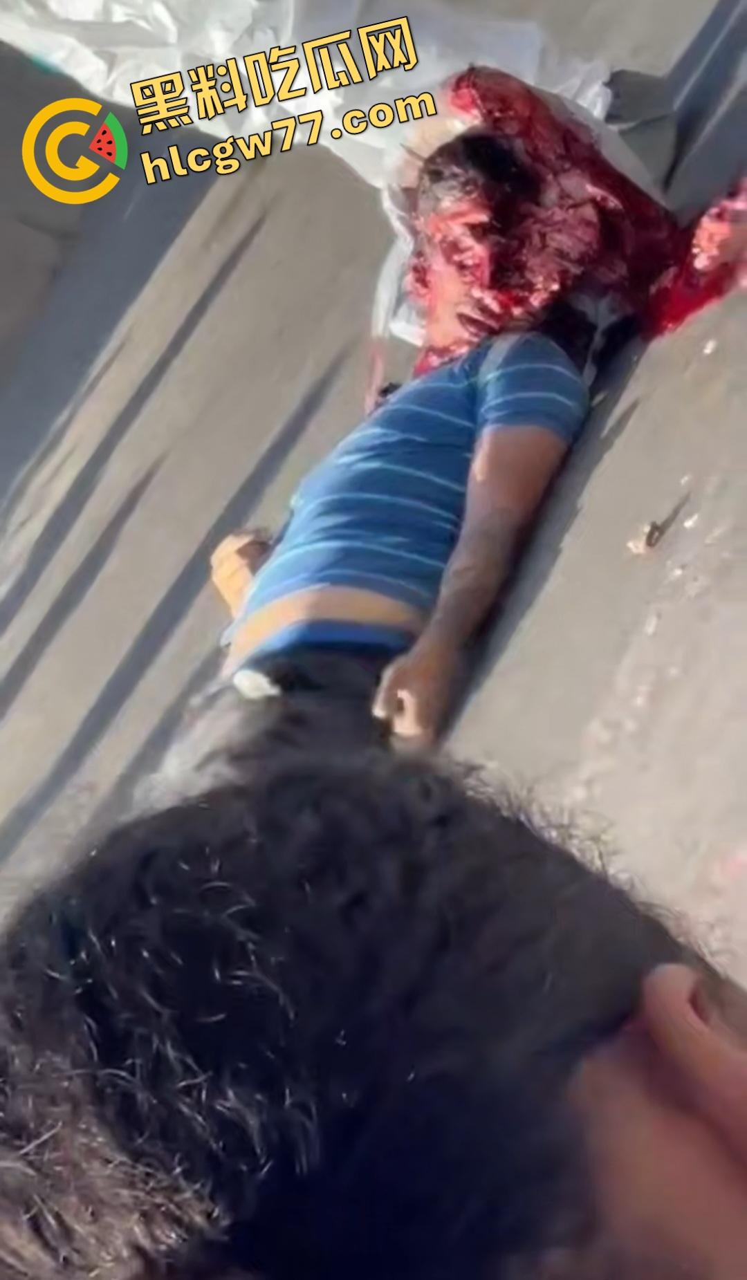 蓝色衣服男电动车车祸爆头血腥惨剧！眼珠弹出还能救？世上竟有神人？  第3张