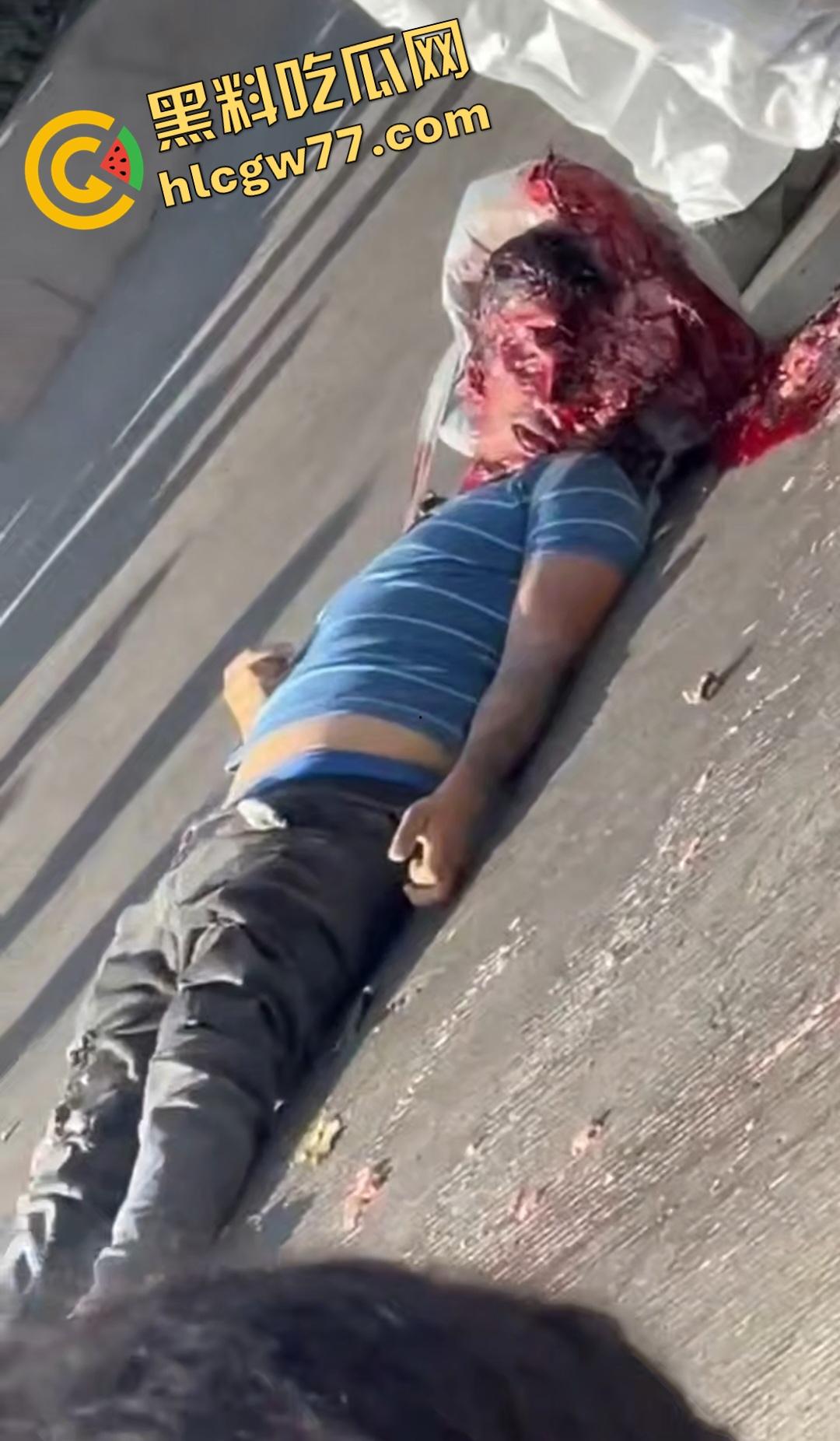 蓝色衣服男电动车车祸爆头血腥惨剧！眼珠弹出还能救？世上竟有神人？  第4张