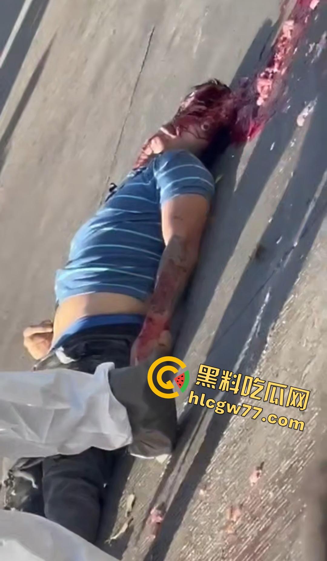 蓝色衣服男电动车车祸爆头血腥惨剧！眼珠弹出还能救？世上竟有神人？  第5张