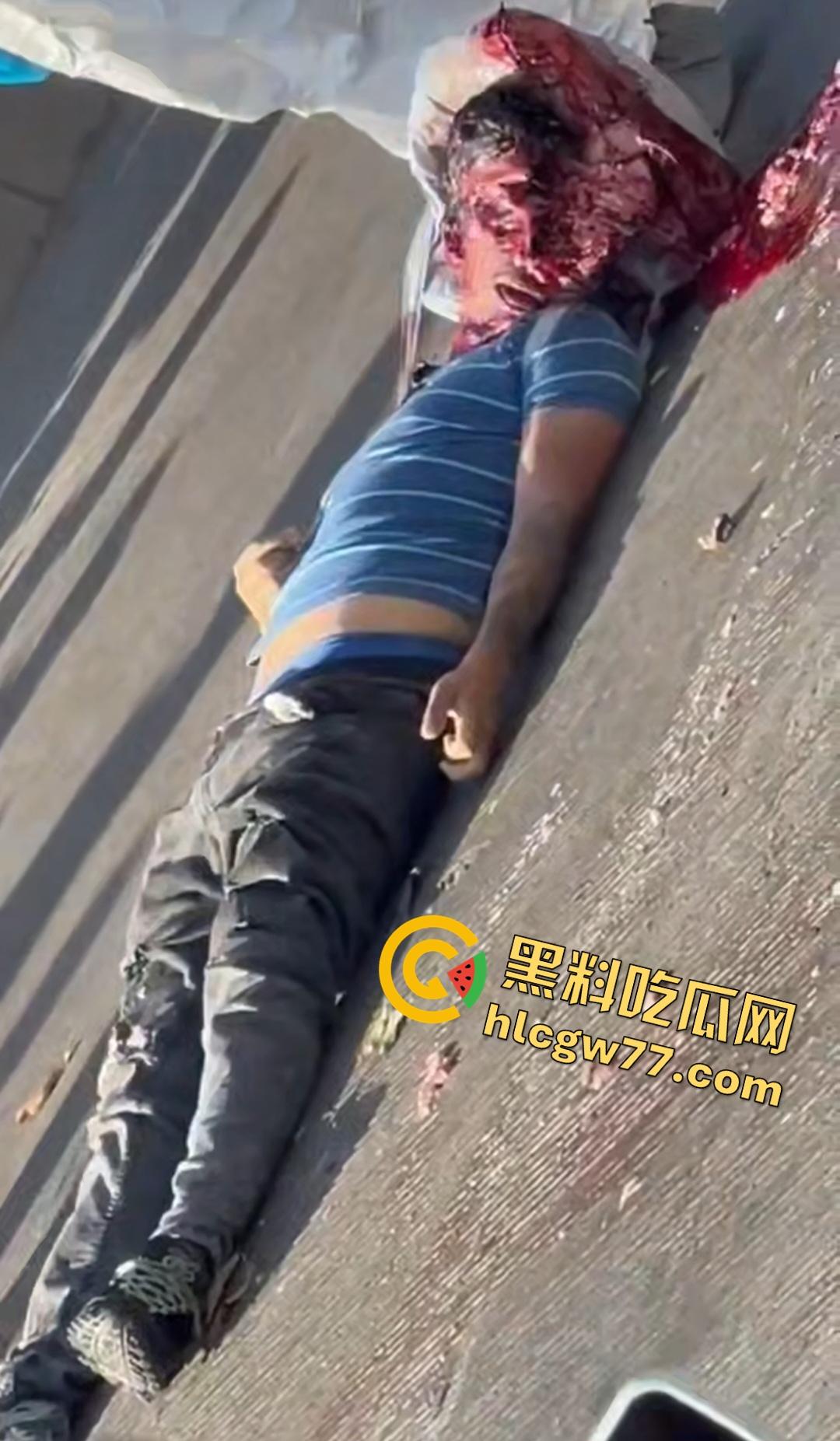 蓝色衣服男电动车车祸爆头血腥惨剧！眼珠弹出还能救？世上竟有神人？  第7张