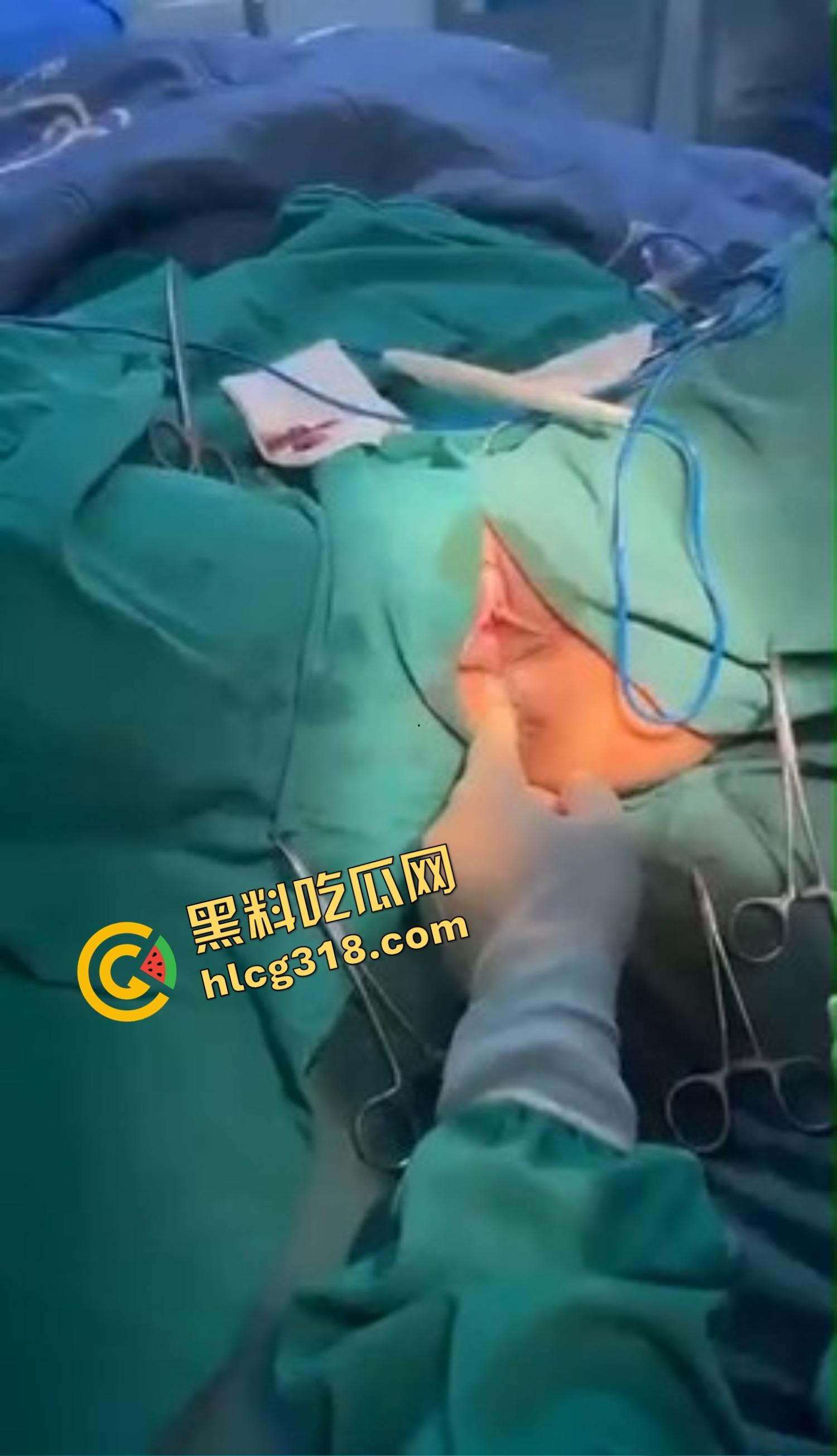 你还以为高端外围豪车天生紧？全靠阴道收缩术收成死夹货，富哥上手就说一根手指进去都得抹油！  第6张