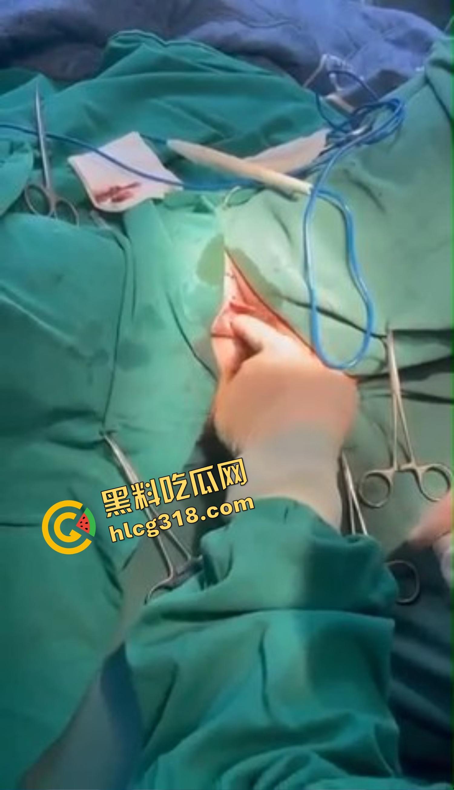 你还以为高端外围豪车天生紧？全靠阴道收缩术收成死夹货，富哥上手就说一根手指进去都得抹油！  第7张