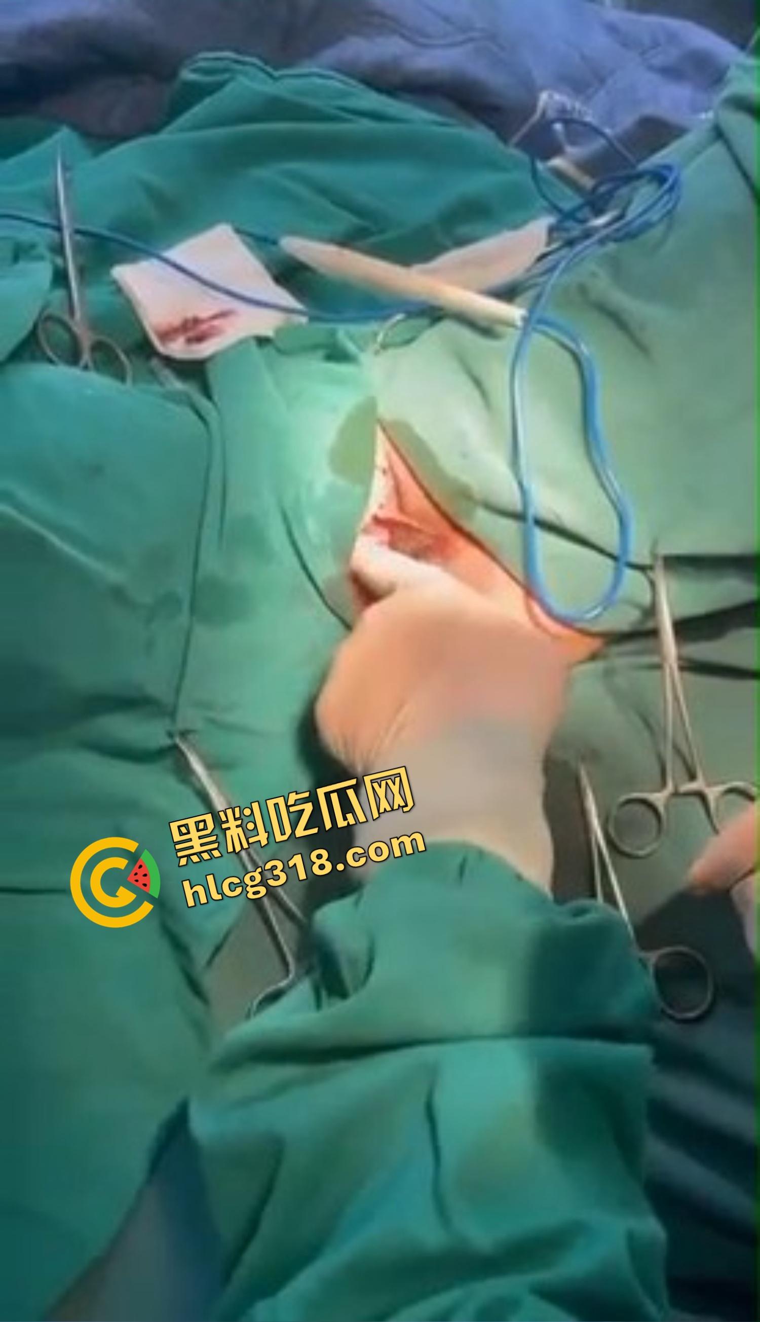 你还以为高端外围豪车天生紧？全靠阴道收缩术收成死夹货，富哥上手就说一根手指进去都得抹油！  第8张