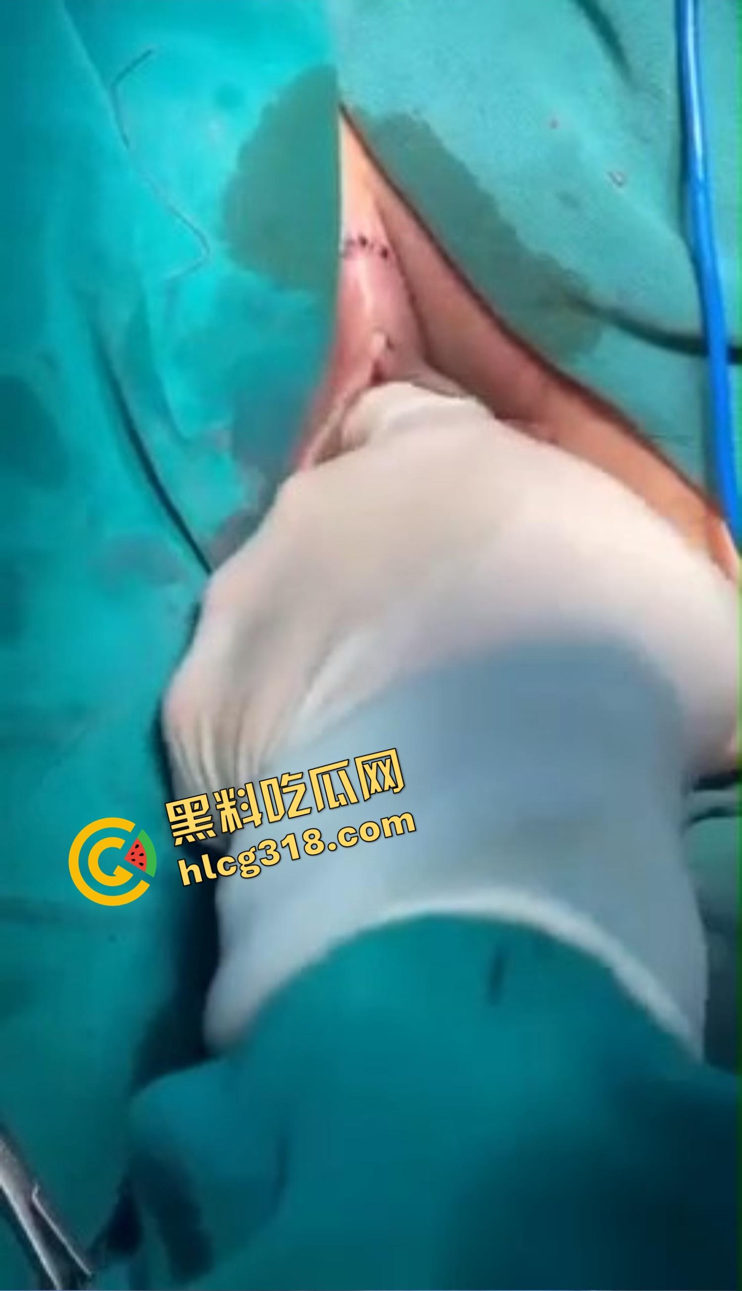 你还以为高端外围豪车天生紧？全靠阴道收缩术收成死夹货，富哥上手就说一根手指进去都得抹油！  第9张