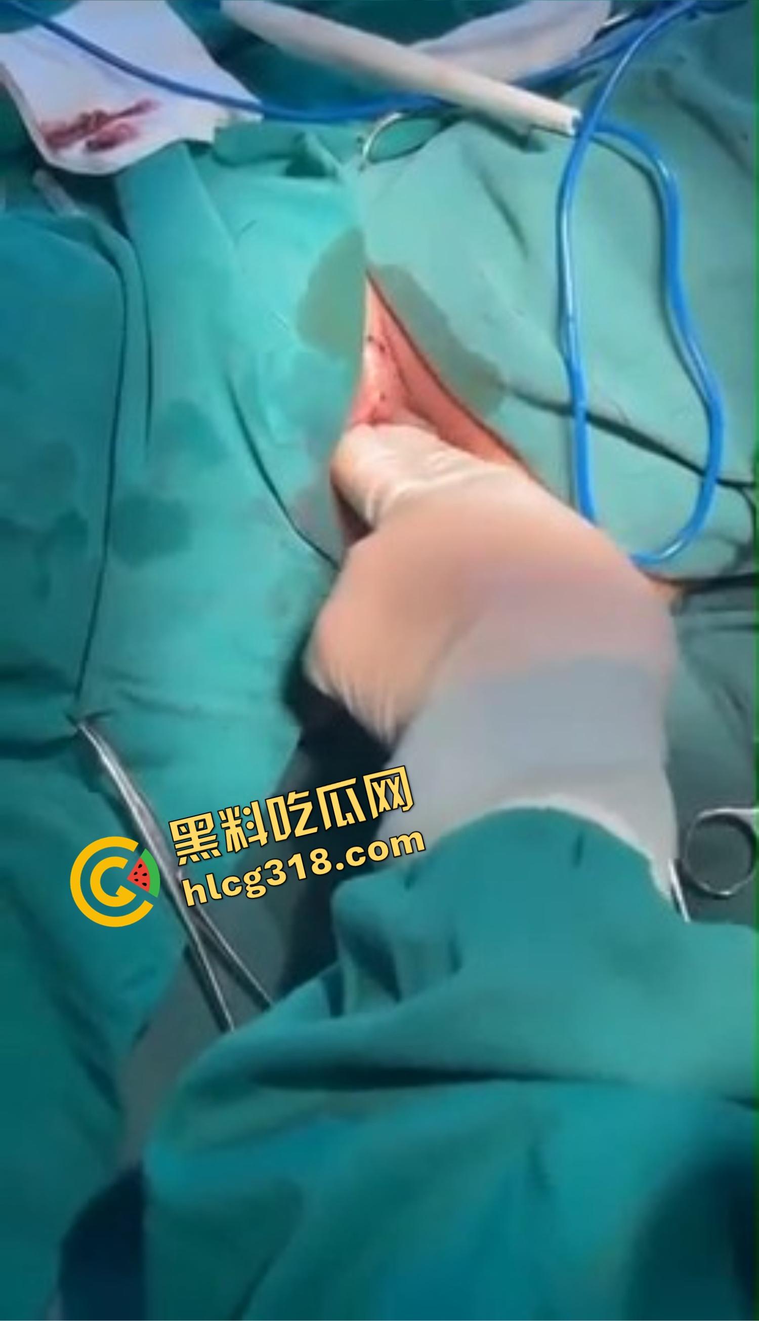 你还以为高端外围豪车天生紧？全靠阴道收缩术收成死夹货，富哥上手就说一根手指进去都得抹油！  第10张