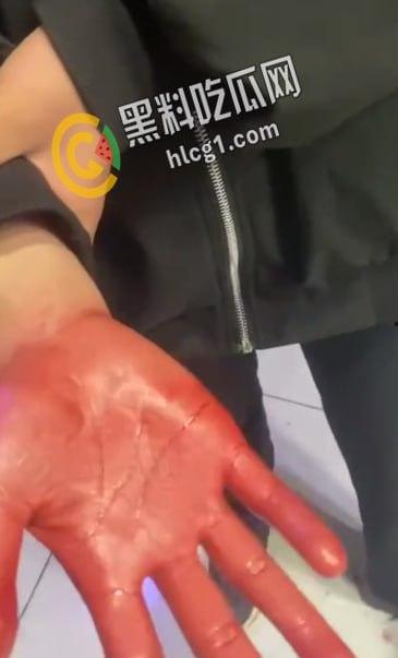 青海西宁 一女孩在酒店里遭多人暴打侮辱 扇耳光割头发 还逼迫女孩脱光全身衣服拍照！  第6张