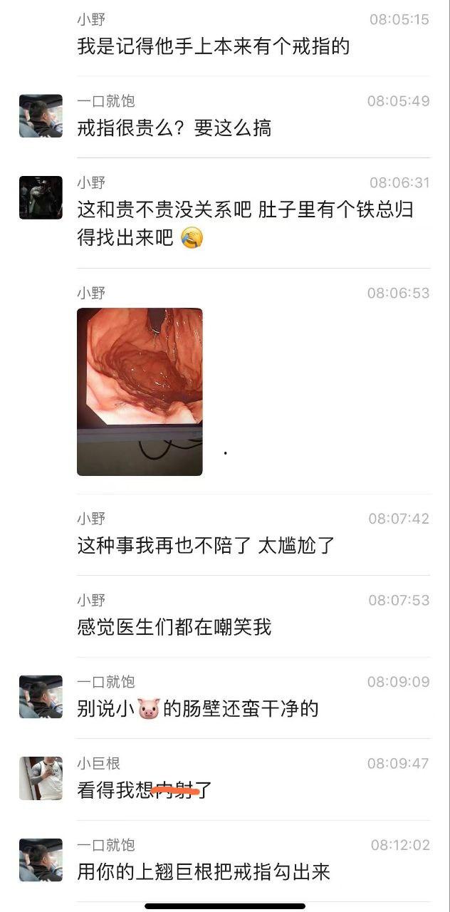 金主酒吧消费巨款，陪酒女为博金主一笑，酒后拳交，玩大了，金主爸爸手上戒指卡里面！  第4张