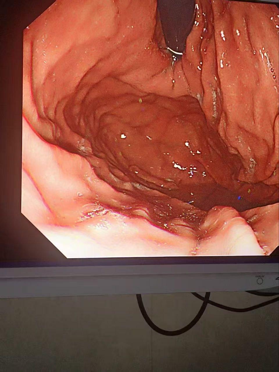 金主酒吧消费巨款，陪酒女为博金主一笑，酒后拳交，玩大了，金主爸爸手上戒指卡里面！  第7张