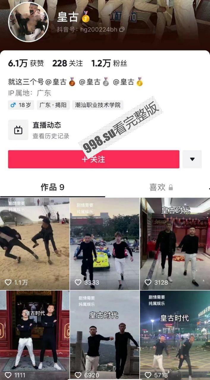 抖音 精神小伙 皇古 直播装逼失败裤裆着火 希望老二还能保住  第1张