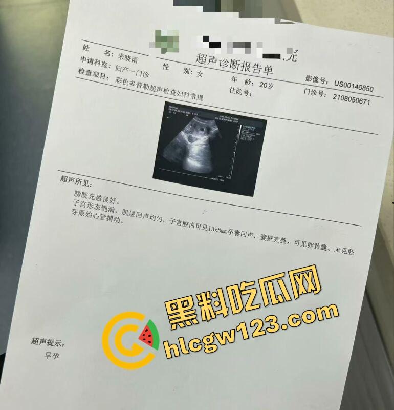 老套路玩不腻,江西老哥约小仙女无套爽完2周内直接中标!说怀孕就怀孕,喜当爹都反应不过来! 第8张 老套路玩不腻,江西老哥约小仙女无套爽完2周内直接中标!说怀孕就怀孕,喜当爹都反应不过来! 第8张