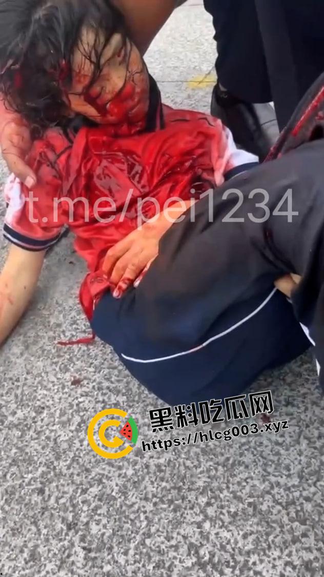 大瓜速递！江西贵溪特大伤人案现场视频流出 暴徒闯进校园狂杀老师和学生 血腥慎入  第3张