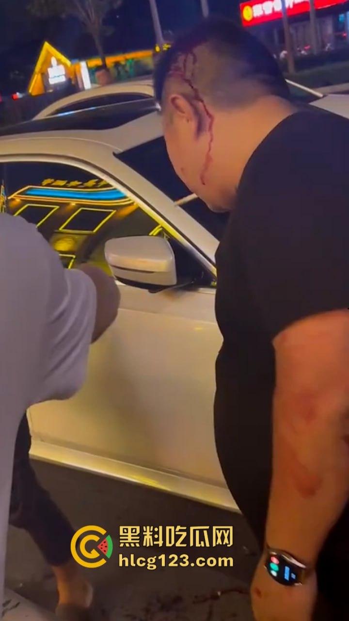 泰州两男子酒后互殴 重拳出击 脑袋都要开花了  第9张