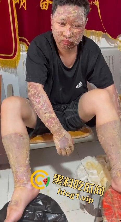 内蒙古呼和浩特惊魂一刻!02年精神小伙偷骑V4机车撞上右转SUV,摩托车当场燃烧! 第8张 内蒙古呼和浩特惊魂一刻!02年精神小伙偷骑V4机车撞上右转SUV,摩托车当场燃烧! 第8张