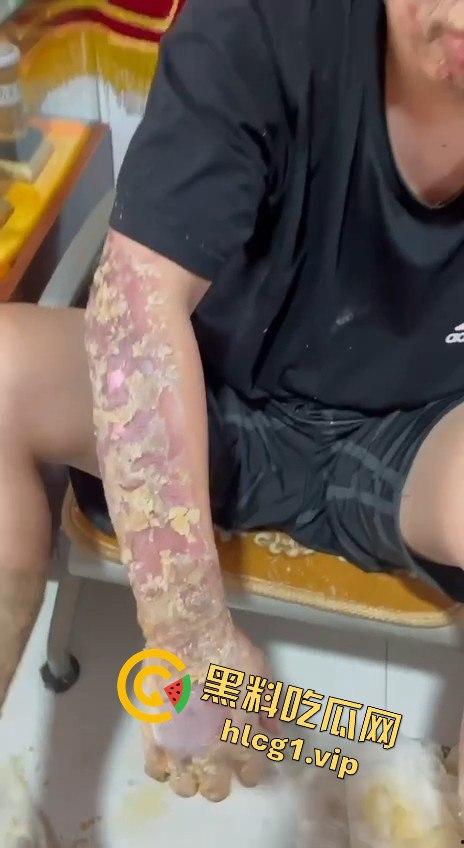 内蒙古呼和浩特惊魂一刻!02年精神小伙偷骑V4机车撞上右转SUV,摩托车当场燃烧! 第9张 内蒙古呼和浩特惊魂一刻!02年精神小伙偷骑V4机车撞上右转SUV,摩托车当场燃烧! 第9张