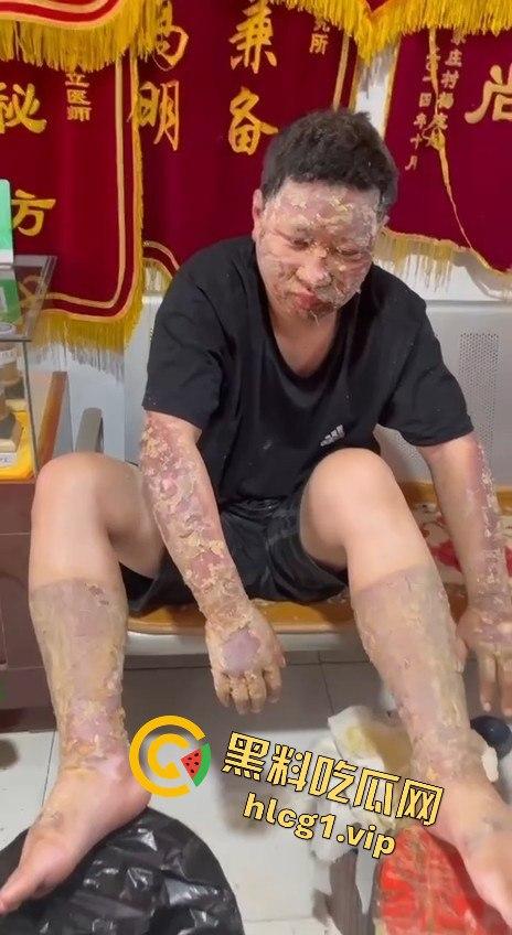 内蒙古呼和浩特惊魂一刻!02年精神小伙偷骑V4机车撞上右转SUV,摩托车当场燃烧! 第10张 内蒙古呼和浩特惊魂一刻!02年精神小伙偷骑V4机车撞上右转SUV,摩托车当场燃烧! 第10张