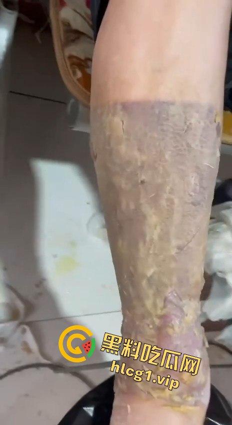 内蒙古呼和浩特惊魂一刻!02年精神小伙偷骑V4机车撞上右转SUV,摩托车当场燃烧! 第11张 内蒙古呼和浩特惊魂一刻!02年精神小伙偷骑V4机车撞上右转SUV,摩托车当场燃烧! 第11张