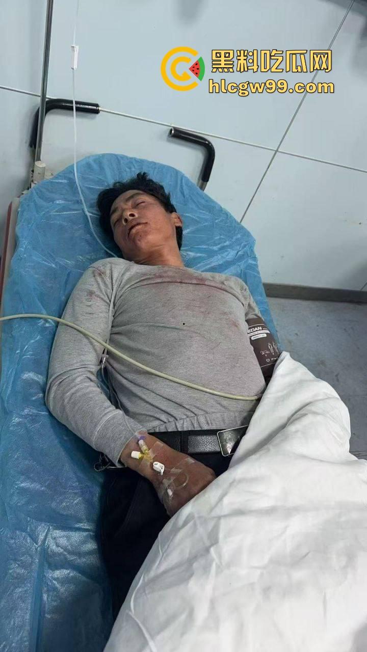 广东汕头潮阳西胪市场因生意太曝火而遭同行报复,现当事人已进医院,现场惨烈曝光! 第1张 广东汕头潮阳西胪市场因生意太曝火而遭同行报复,现当事人已进医院,现场惨烈曝光! 第1张