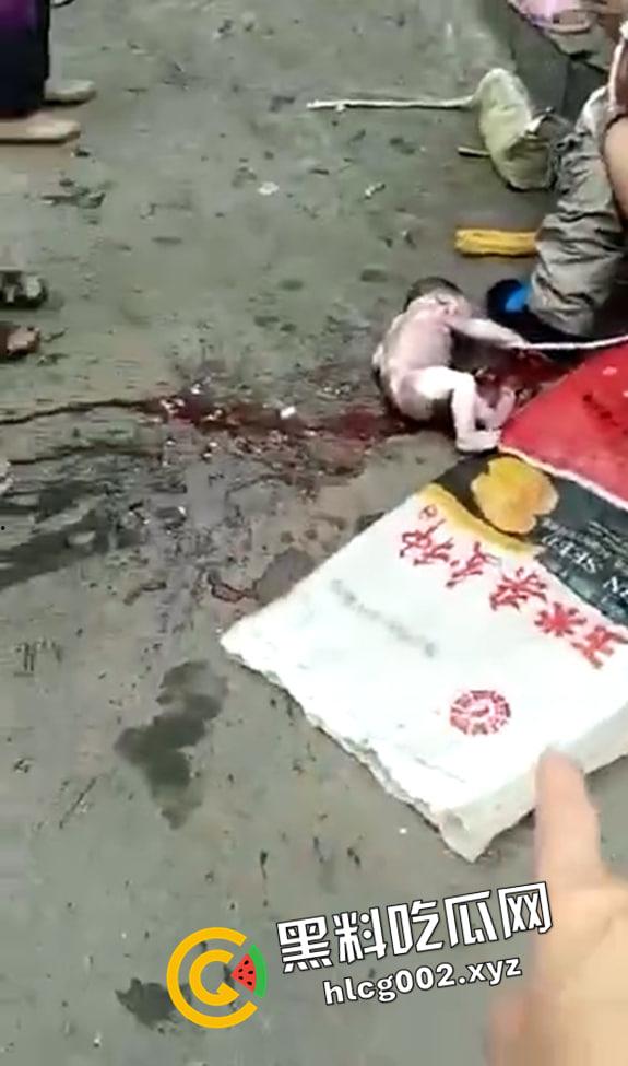 妇女当街站着生小孩 直接就拉出来了 现场视频流出 血腥慎入  第3张