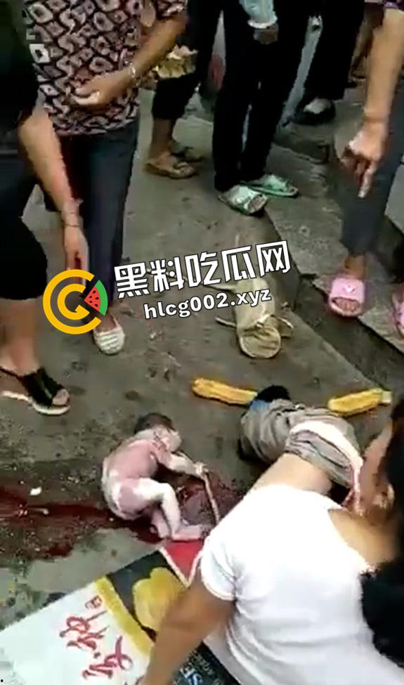 妇女当街站着生小孩 直接就拉出来了 现场视频流出 血腥慎入  第6张