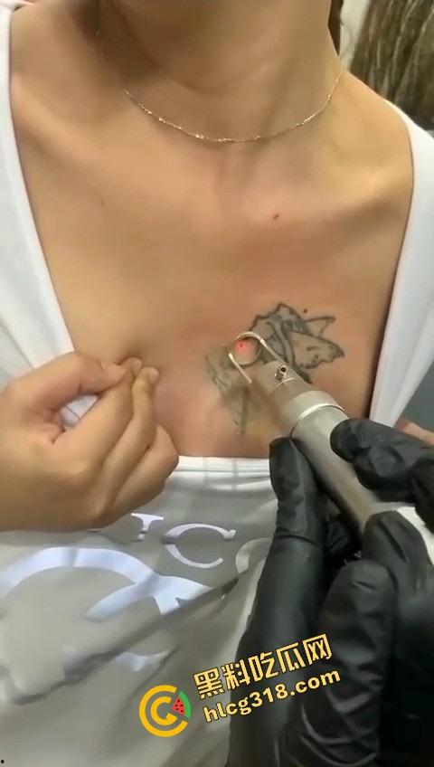 纹的时候笑得像疯子，洗的时候哭得像狗，精神小妹胸口洗纹身，找到接盘侠就开始洗过往了？  第8张