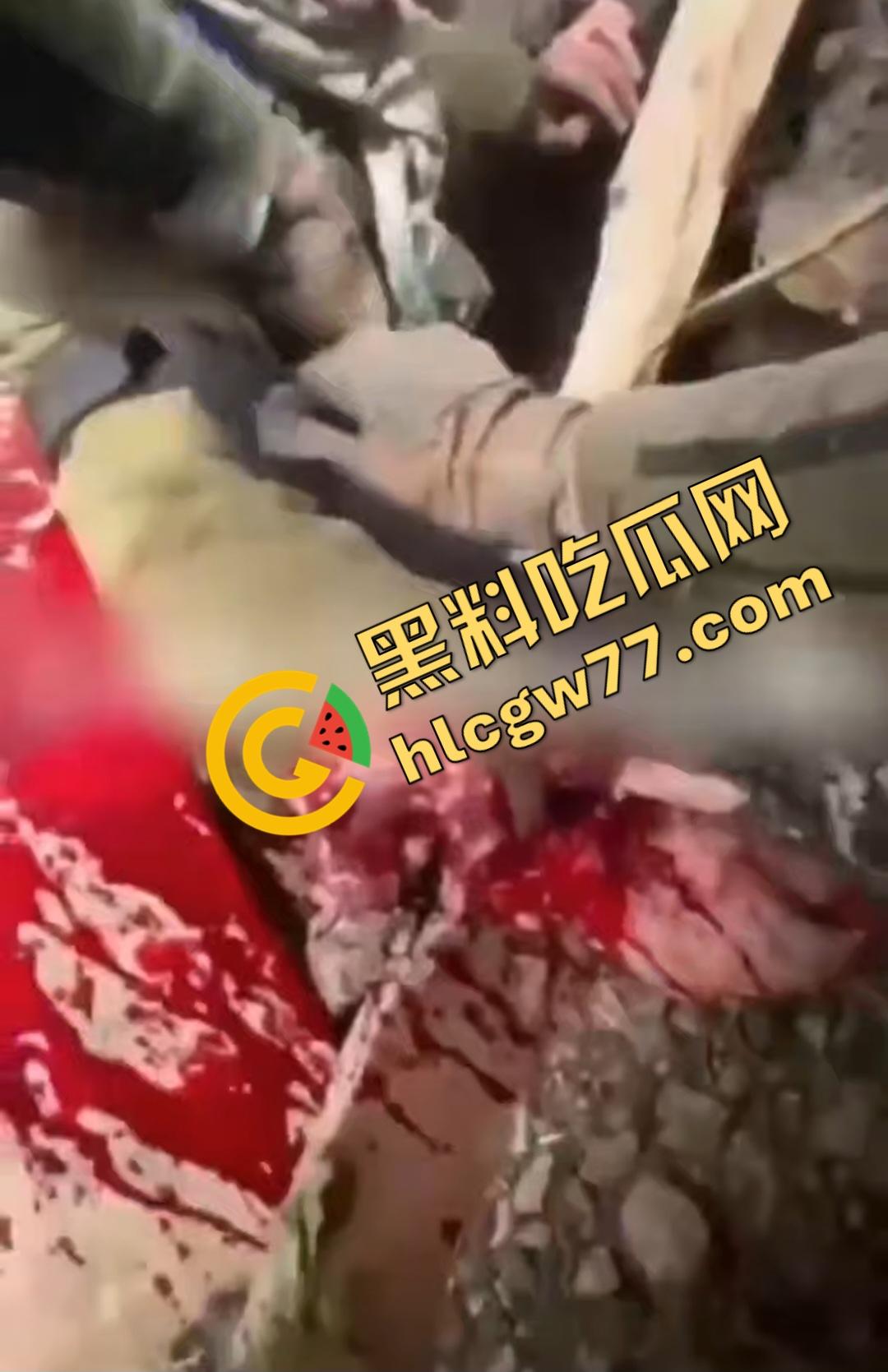 俄乌战场出现食人兵？士兵炸弹炸飞手臂骨髓喷溅，一旁队友饿了还吸食血液充饥！  第2张