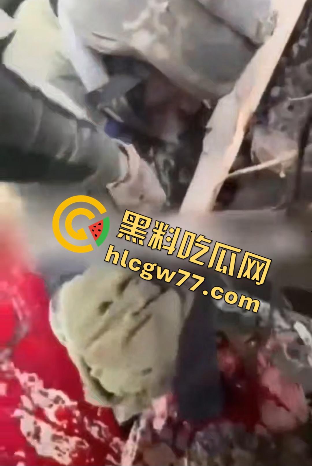 俄乌战场出现食人兵？士兵炸弹炸飞手臂骨髓喷溅，一旁队友饿了还吸食血液充饥！  第4张