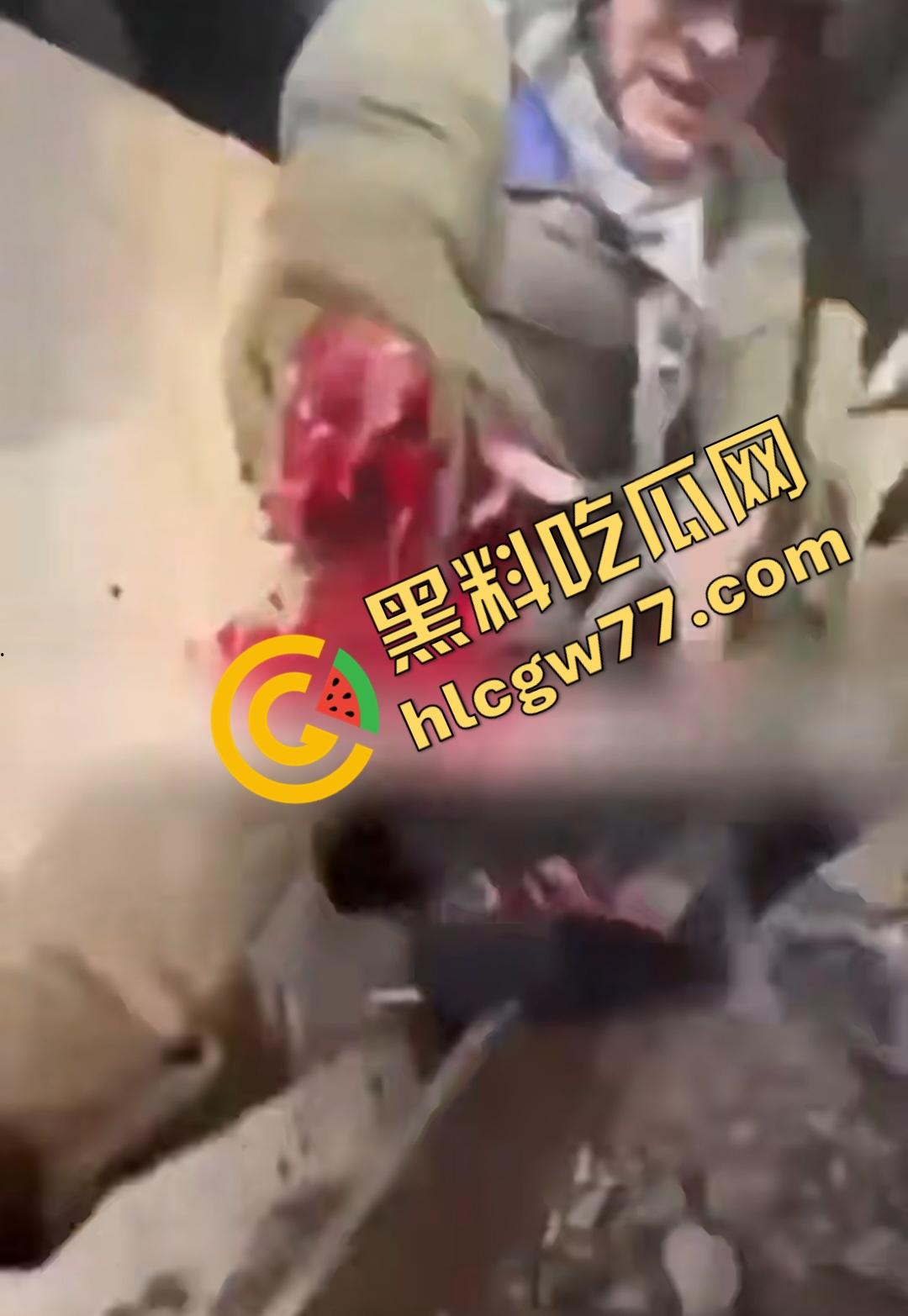 俄乌战场出现食人兵？士兵炸弹炸飞手臂骨髓喷溅，一旁队友饿了还吸食血液充饥！  第8张